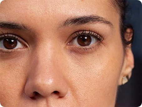 Rote Augen beim Cannabis-Konsum: Was passiert wirklich bei der Wirkung vom grünen Kraut auf unsere Augen? Rote Augen beim Cannabis Konsum: Was passiert wirklich